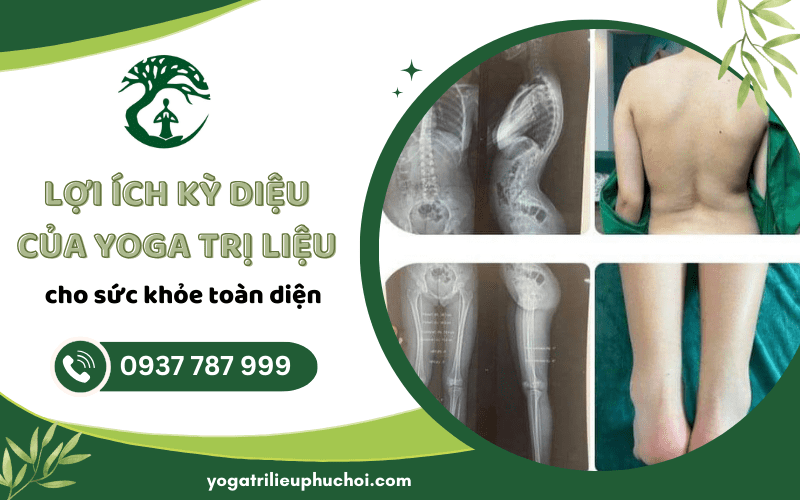 Yoga trị liệu