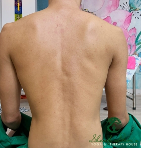 Kết quả điều trị cột sống 10