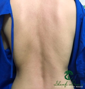 Kết quả điều trị cột sống 11