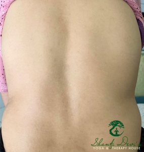 Kết quả điều trị cột sống 4