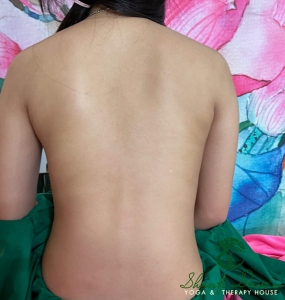 Kết quả điều trị cột sống 8